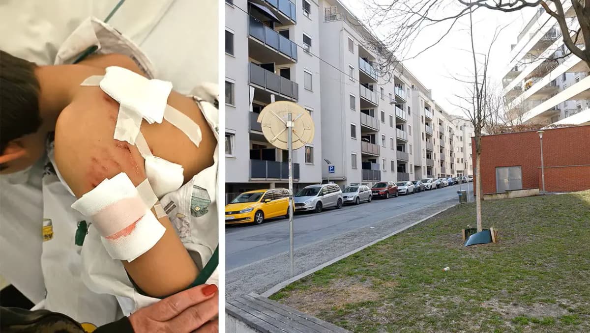 Ребёнок в больнице, хозяин под следствием: очередное нападение собаки в Австрии